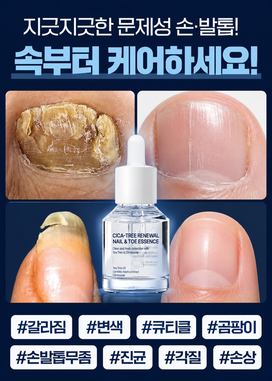 시카트리 네일에센스 15ml 2개입 구매 전 확인할 점은? 4